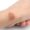 Rashes That Look Like Ringworm But Aren't_ Common Conditions